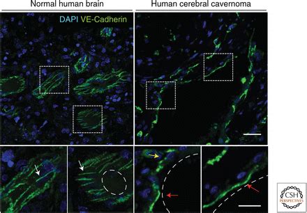 Vascular Endothelial (VE)-Cadherin, Endothelial Adherens Junctions, and Vascular Disease