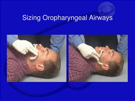 Oropharyngeal Airway Sizes