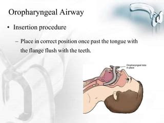 Oral Airway Presentation | PPT