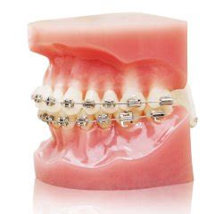 Braces New York City, Upper East Side, Greenwich Village, West Village | Dr. Michelle Katz