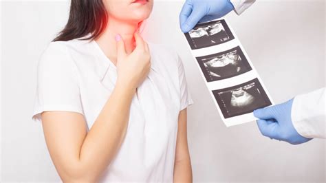 Agranulocytosis-Diagnosis & Treatment