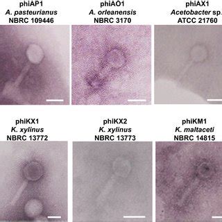 Schematic representation of temperate phage genomes in AAB. (A) Genome ...