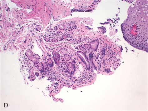 Esophagus | Abdominal Key