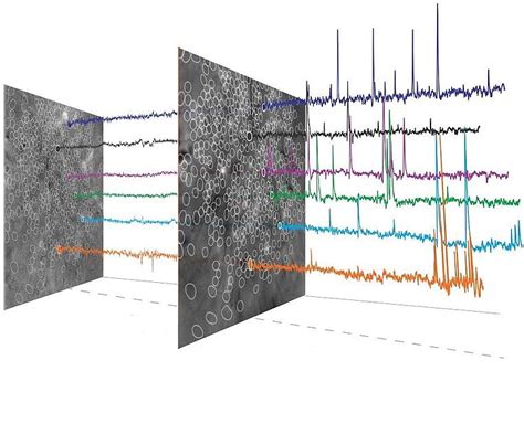 [News Roundup] The Beginning of A New Chapter in Brain Mapping ...