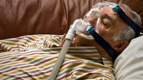 Sleep apnea implants for tongue to be tested | CBC News