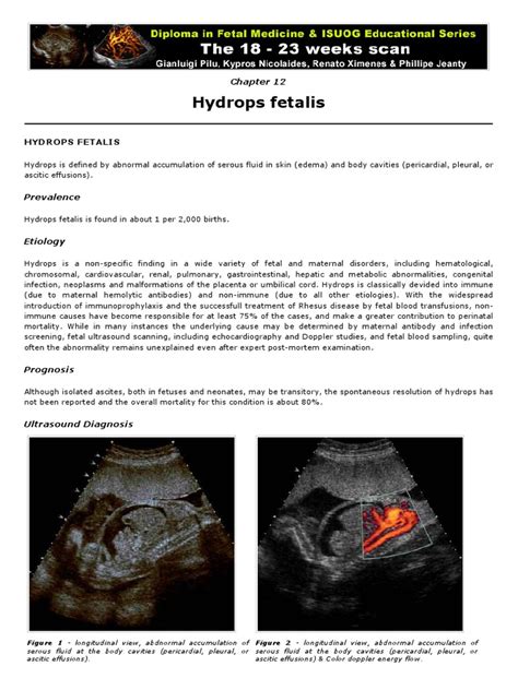 Hydrops Fetalis | PDF | Fetus | Anatomy