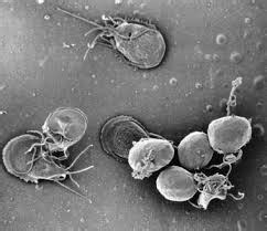 Microsporidia Infection