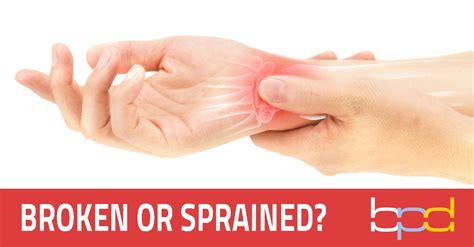 Treating a Sprained Wrist Causes, Symptoms, and Recovery