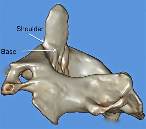 (PDF) The Dens: A Review of its Diverse Nomenclature and a Recommended ...