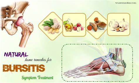 14 Home Remedies For Bursitis Symptom Treatment