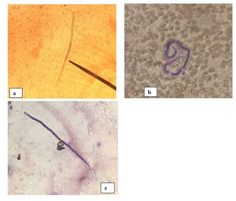 (a) Microfilaria of Dirofilaria immitis, observed in examination of ...