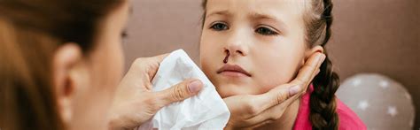 Nose Cauterisation - Treatment for Nosebleeds | ENT Specialists Group