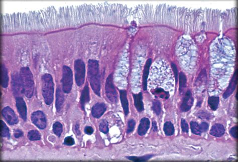 Pseudostratified Columnar Epithelium Diagram | Quizlet