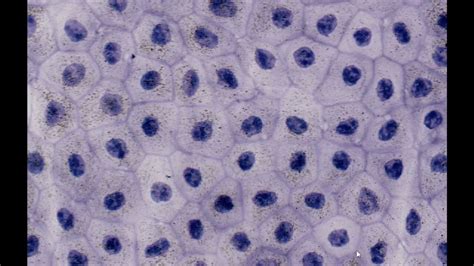 Mesothelium Histology