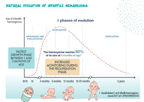 What Is Infantile Hemangioma - Hemangeol