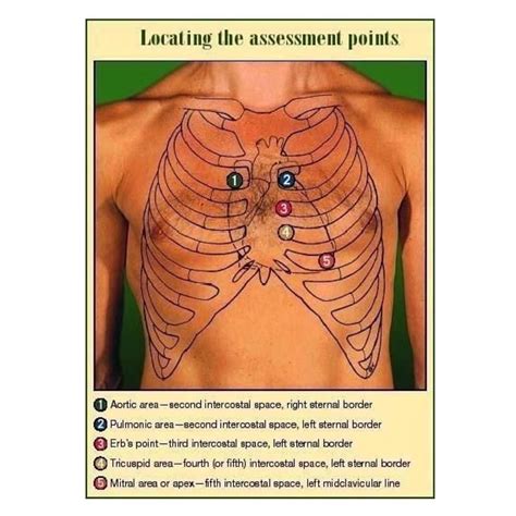 Cardiac auscultation points | Cardiac auscultation, Pathophysiology nursing, Cardiac