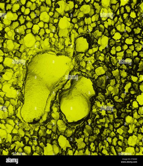 Healthy Lung Alveoli Stockfotos und -bilder Kaufen - Alamy