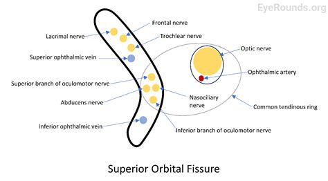 EyeRounds.org: Superior Orbital Fissure Syndrome