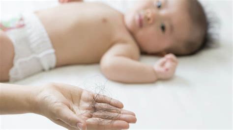 Baby Hair Loss: Facts, Causes, Treatments, and More!