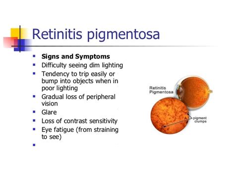 Retinitis pigmentosa 3