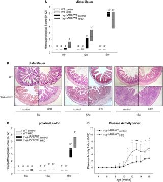 High Fat Diet Accelerates Pathogenesis of Murine Crohn’s Disease-Like Ileitis Independently of ...