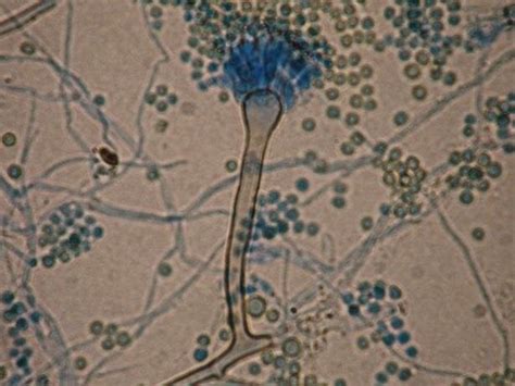 Aspergillus nidulans | Download Scientific Diagram