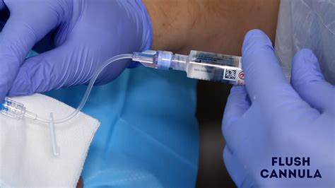 Intravenous Cannulation Procedure - OSCE Guide | Geeky Medics