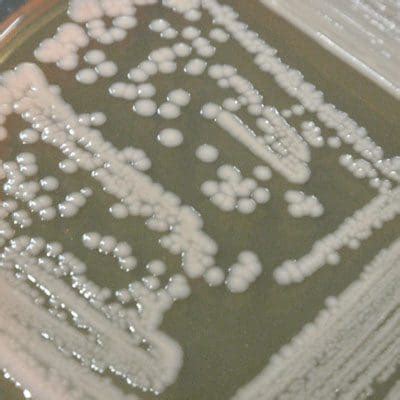 Enterobacter Aerogenes Morphology