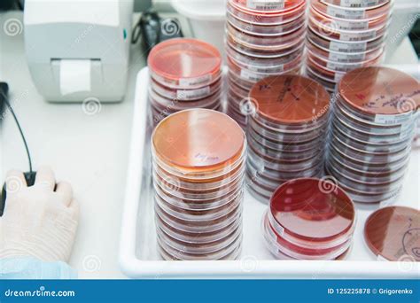 Microbiology Research in Laboratory Stock Photo - Image of experiment ...