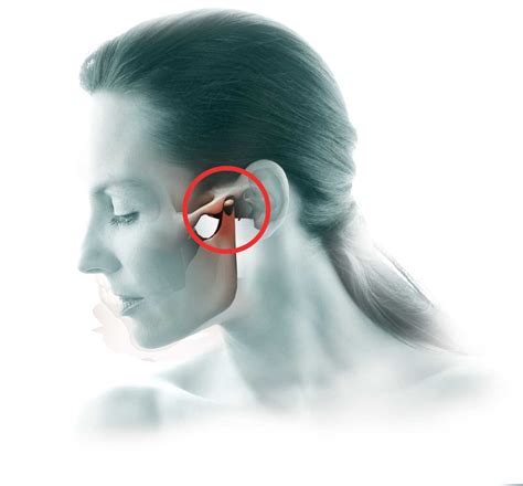 Antiterapia: OSTEOPATIA E ARTICULAÇÃO TEMPOROMANDIBULAR