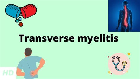 Transverse Myelitis, Causes, Signs and Symptoms, Diagnosis and Treatment. - YouTube