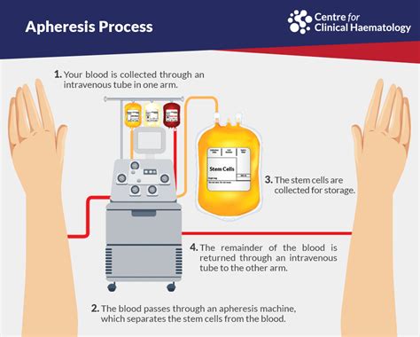 Autologous peripheral blood stem cell transplant | CFCH | Centre for Clinical Haematology