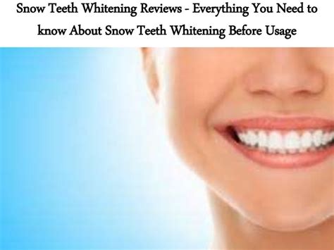 Snow Teeth Whitening Reviews - Everything You Need to know About Snow…