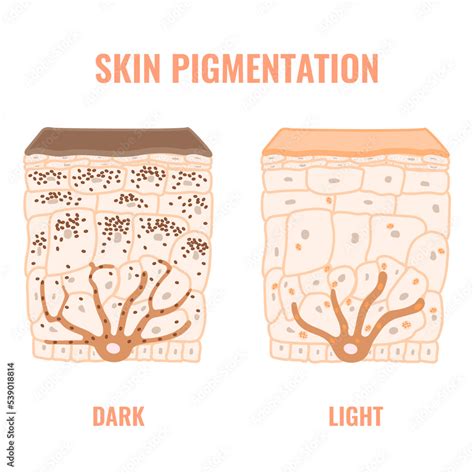 Vecteur Stock Melanin content and distribution in different skin phototypes. Pigmentation ...