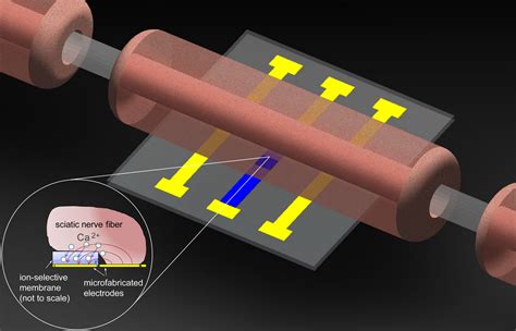 Improved neurostimulators reduce pain « Kurzweil