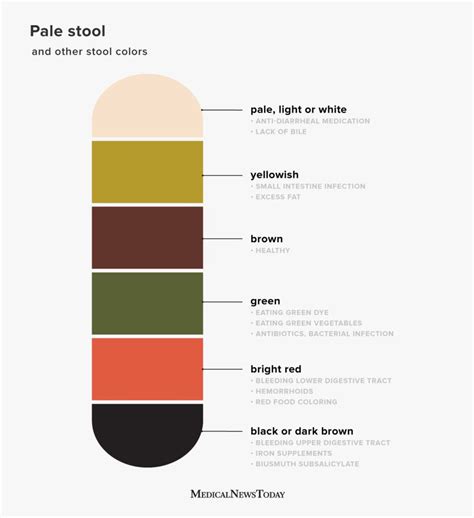 Pale stool: causes, diagnosis, and treatment