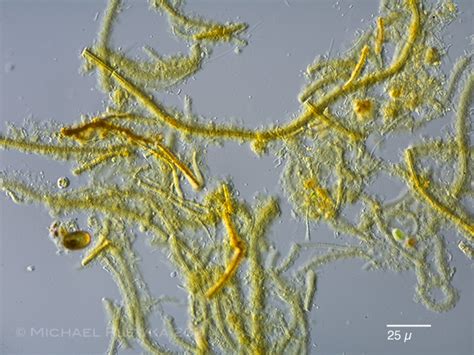 Freshwater and other micro-organisms from Germany: Leptothrix ochracea, Burkholderiales, Bacteria