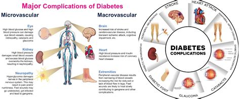 How to Control Type 2 Diabetes Home Remedies