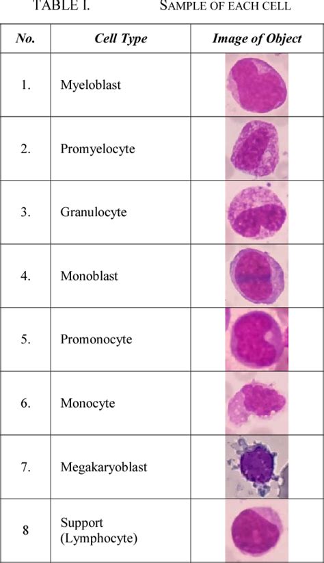 Table I from Classification of cell types in Acute Myeloid Leukemia (AML) of M4, M5 and M7 ...