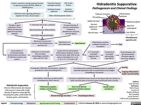 Hidradenitis Suppurativa | Calgary Guide