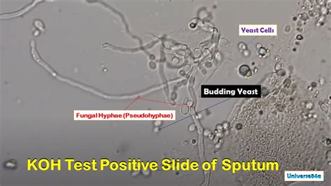 KOH Mount Footages of Various Fungi: Introduction, List of Footages