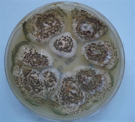 Aspergillus Flavus Under Microscope