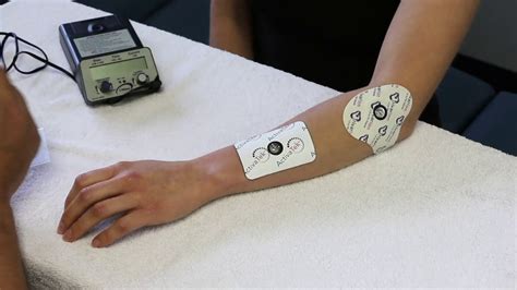 How to set up Iontophoresis? - YouTube