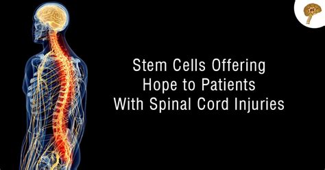 Stem Cells Offering Hope to Patients With Spinal Cord Injuries