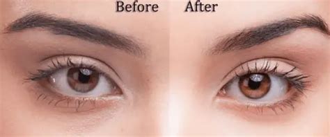 How to Change Your Eye Color, Naturally, Permanently, with Honey, Spell, Surgery, without ...