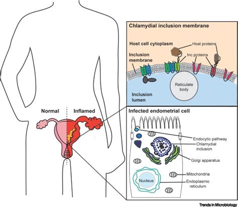 Chlamydia trachomatis: Trends in Microbiology