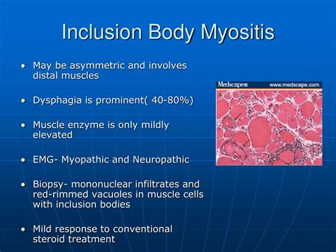 Inclusion Body Myositis Three Stages