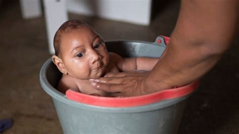 Brazil Zika outbreak: More babies born with birth defects - BBC News