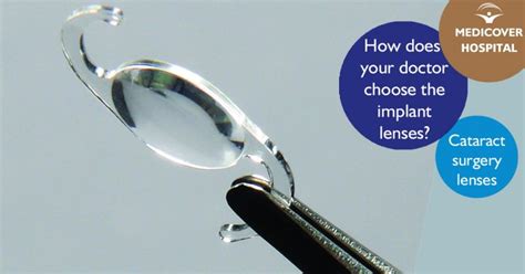 How does your doctor choose the right implant lenses for your cataract ...