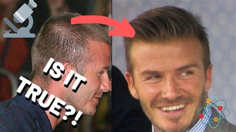 David Beckham Hair Transplant - What's The TRUTH?! | David beckham ...